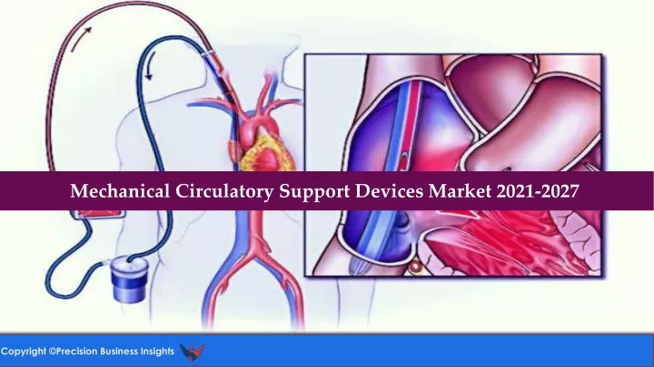 mechanical circulatory support devices market