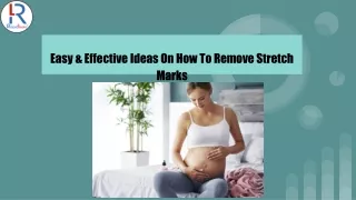 easy effective ideas on how to remove stretch