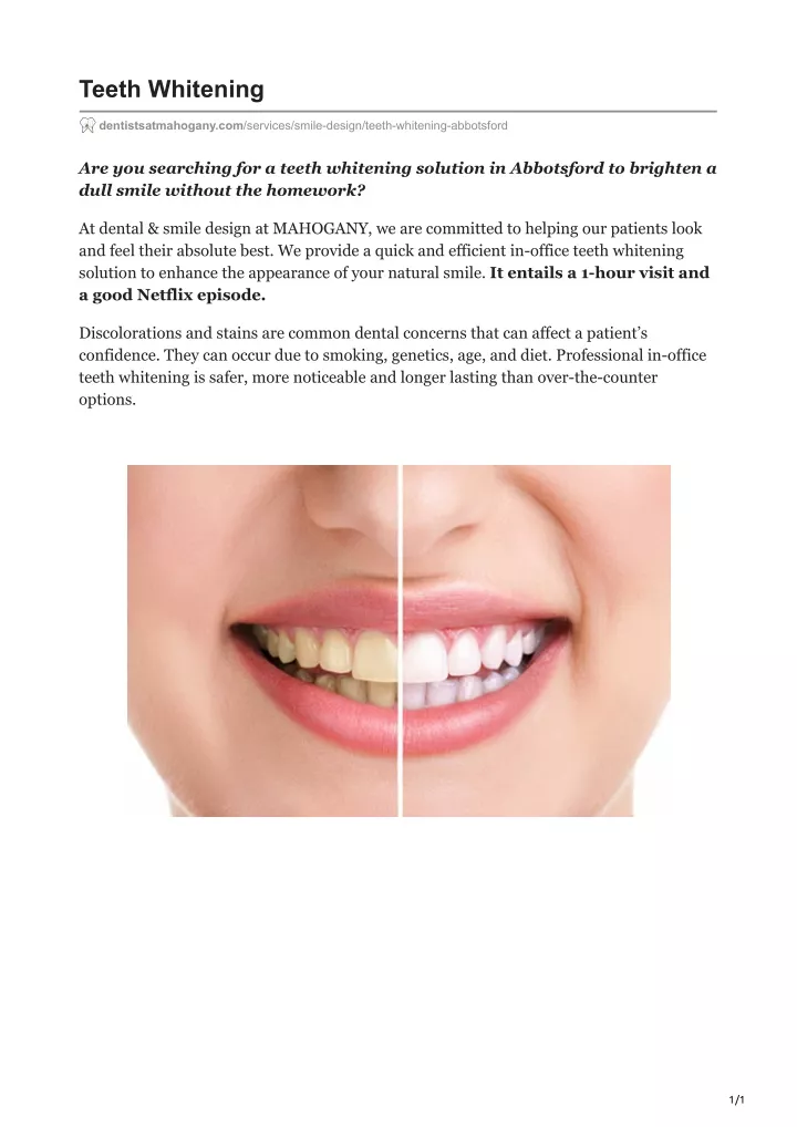 Ppt Teeth Whitening Powerpoint Presentation Free Download Id 10719350