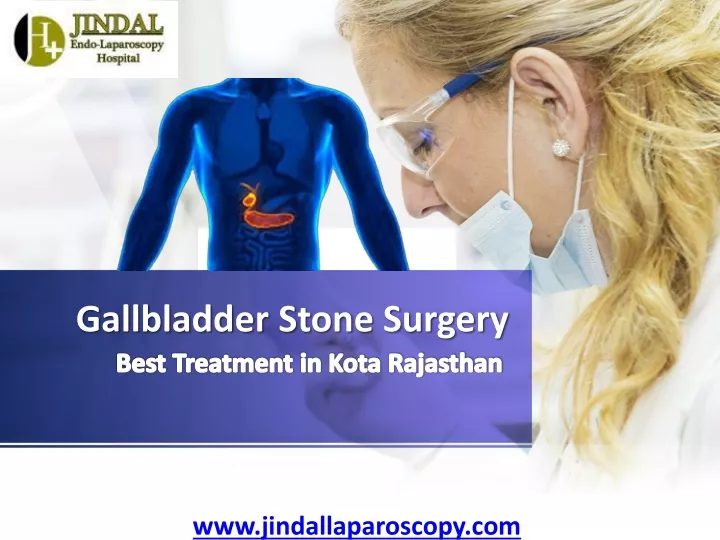 gallbladder stone surgery