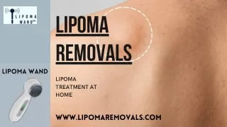 Get the Best Lipoma Treatment Without Surgery at home