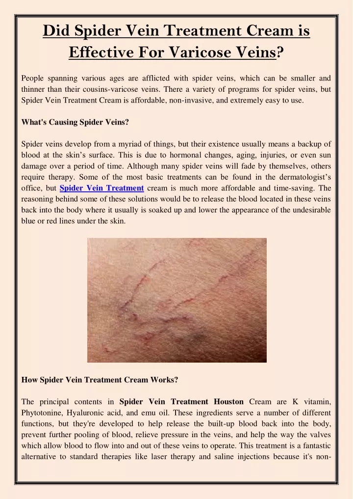did spider vein treatment cream is effective