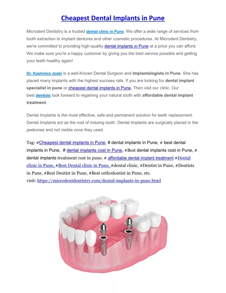 cheapest dental implants in pune