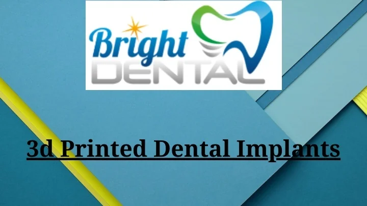 PPT - 3d Printed Dental Implants PowerPoint Presentation, free download ...