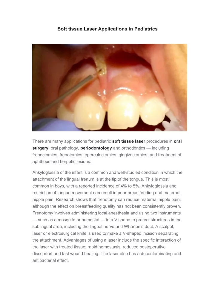 soft tissue laser applications in pediatrics