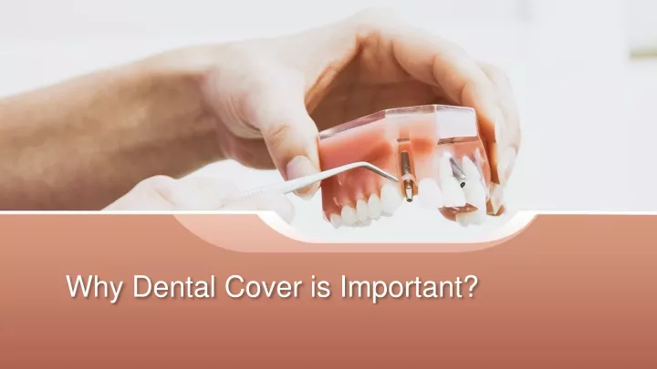 why dental cover is important