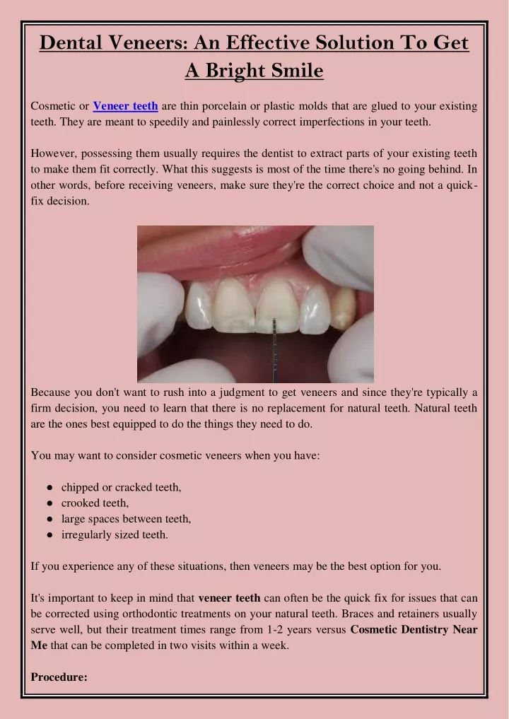 dental veneers an effective solution