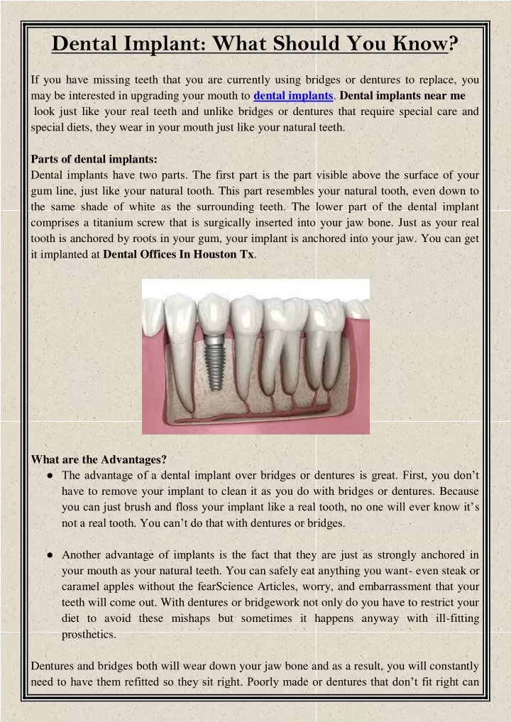 dental implant what should you know