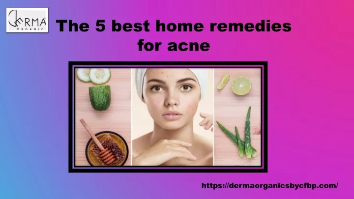 the 5 best home remedies for acne