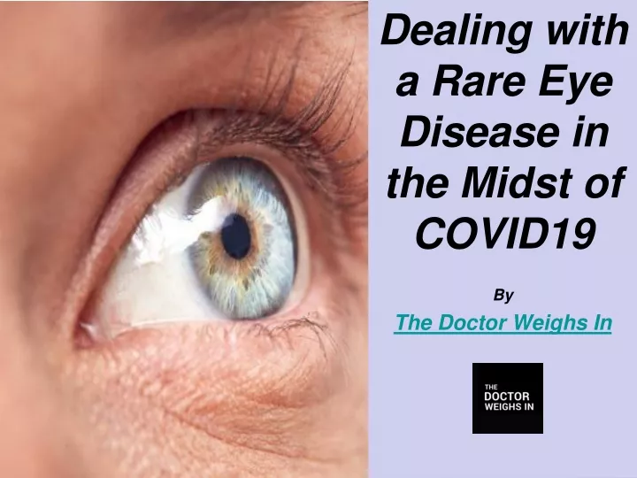 dealing with a rare eye disease in the midst of covid19 by the doctor weighs in