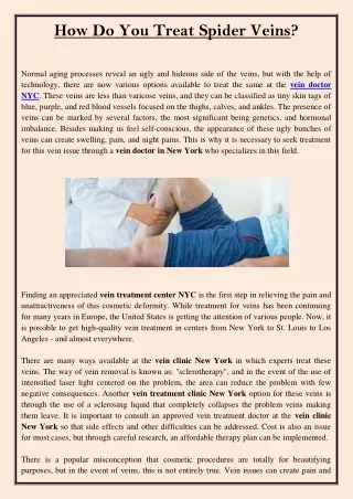 how do you treat spider veins