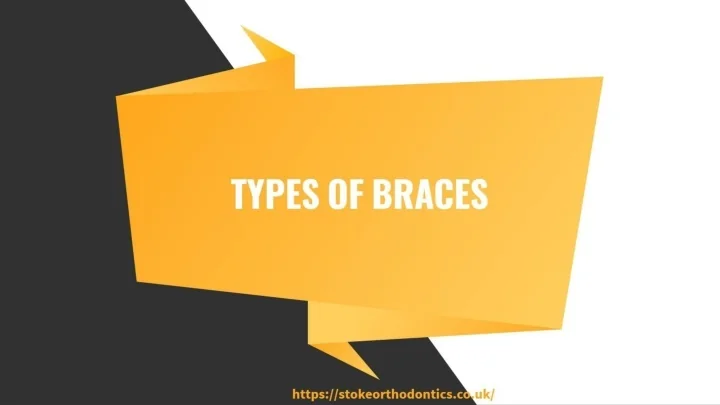 PPT - Different types of braces PowerPoint Presentation, free download ...