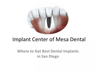 Implant Center of Mesa Dental