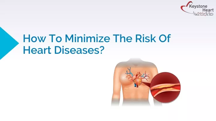 how to minimize the risk of heart diseases