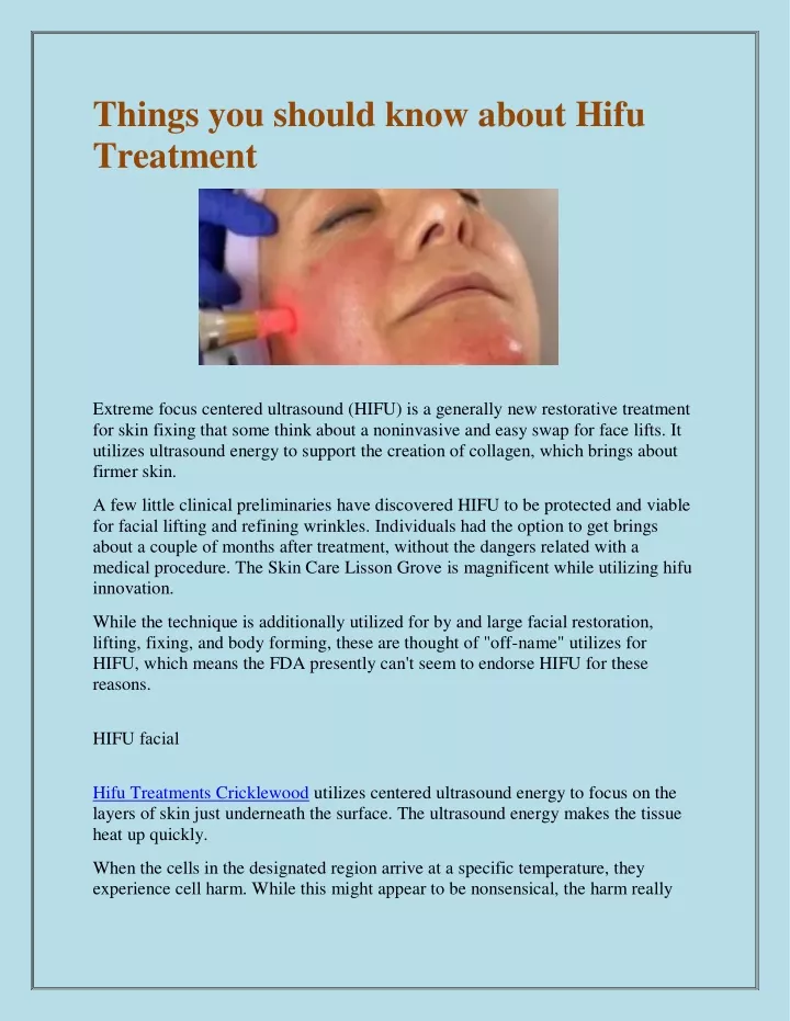 things you should know about hifu treatment