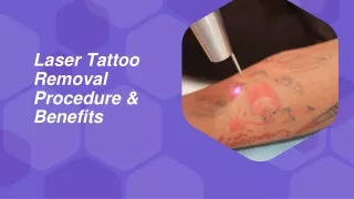 Laser Tattoo Removal Procedure & Benefits