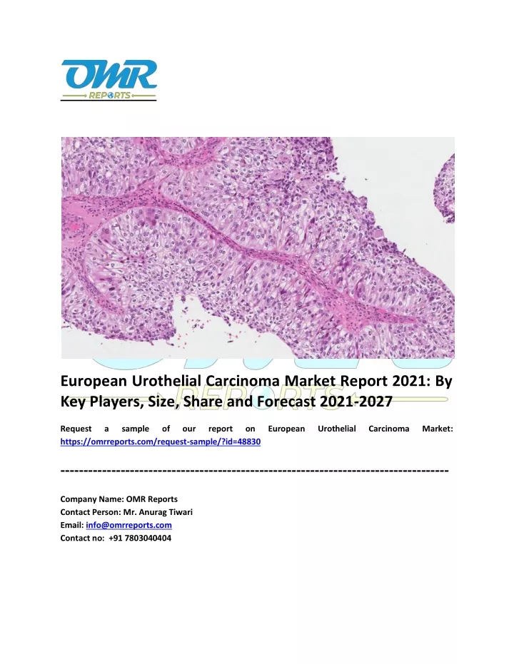 european urothelial carcinoma market report 2021