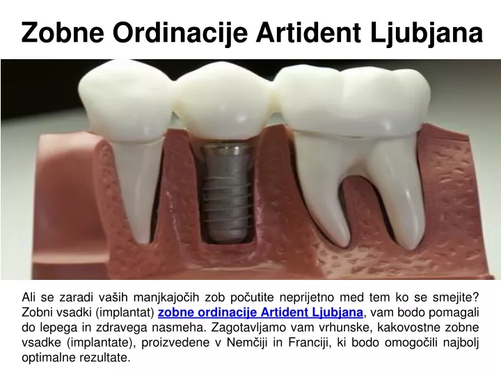 zobne ordinacije artident ljubjana