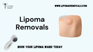 Use Effective Treatment for Lipoma Removals