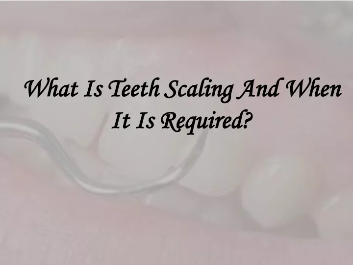 what is teeth scaling and when it is required