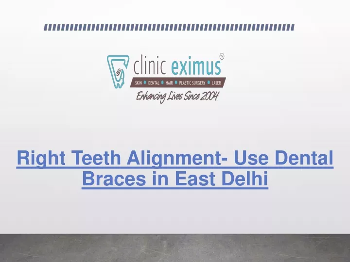right teeth alignment use dental braces in east delhi