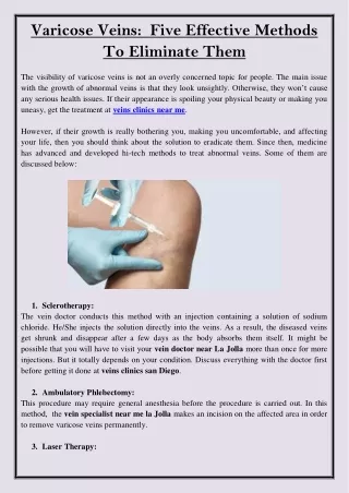Varicose Veins  Five Effective Methods To Eliminate Them