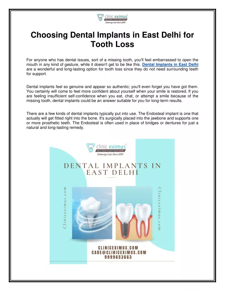 choosing dental implants in east delhi for tooth
