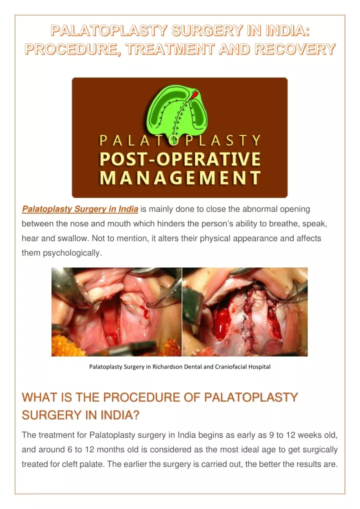 palatoplasty surgery in india is mainly done