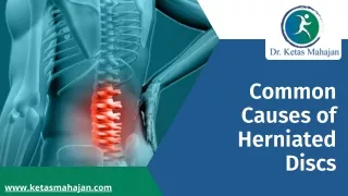 Common Causes of Herniated Discs