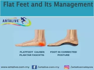 Flat Feet and Its Management
