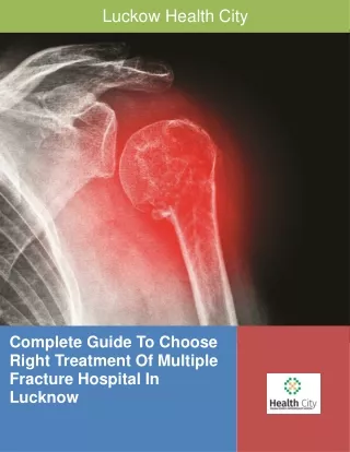 Complete Guide To Choose Right Treatment Of Multiple Fracture Hospital In Lucknow-converted