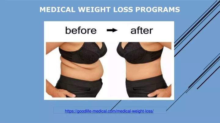 medical weight loss programs