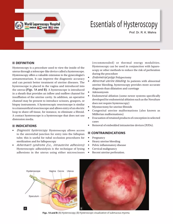 essentials of h ysteroscopy