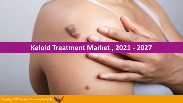 keloid treatment market 2021 2027