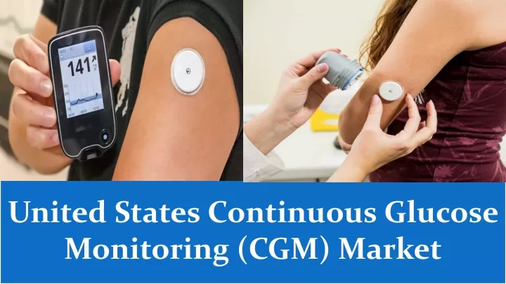 united states continuous glucose monitoring