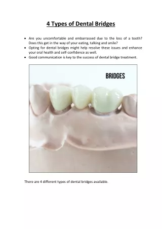 4 Types of Dental Bridges