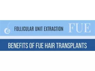 Benefits of FUE Hair Transplants