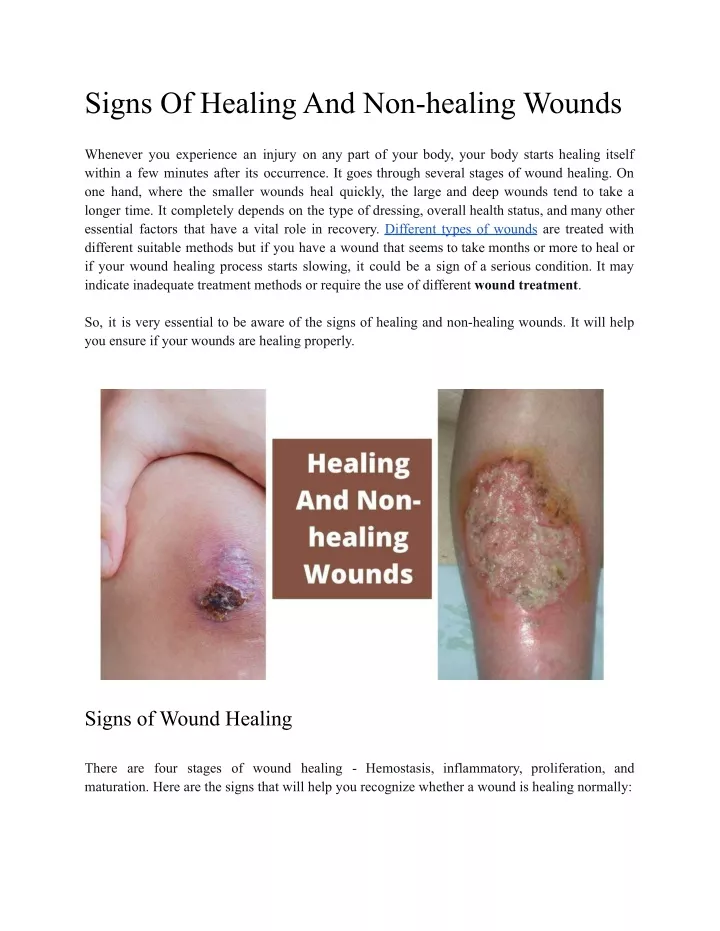 signs of healing and non healing wounds