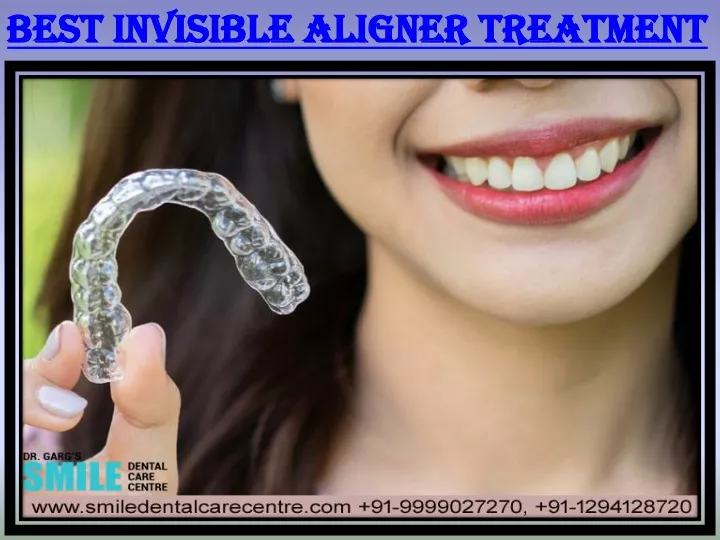 best invisible aligner treatment