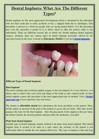 dental implants what are the different types