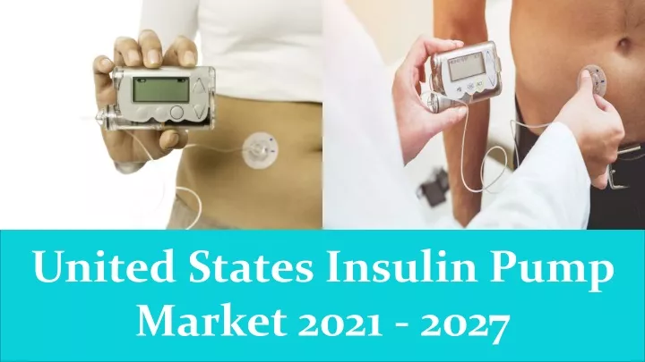 united states insulin pump market 2021 2027