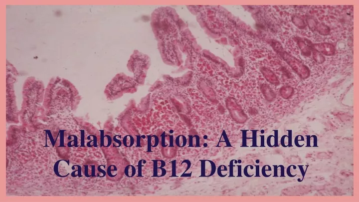 malabsorption a hidden cause of b12 deficiency