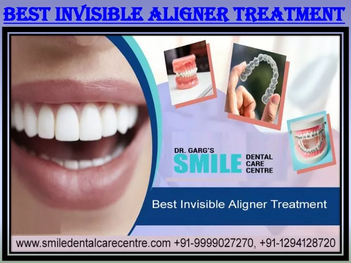 best invisible aligner treatment