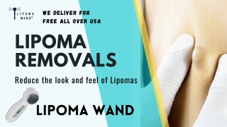 Try the Effective Lipoma Removals without Surgery