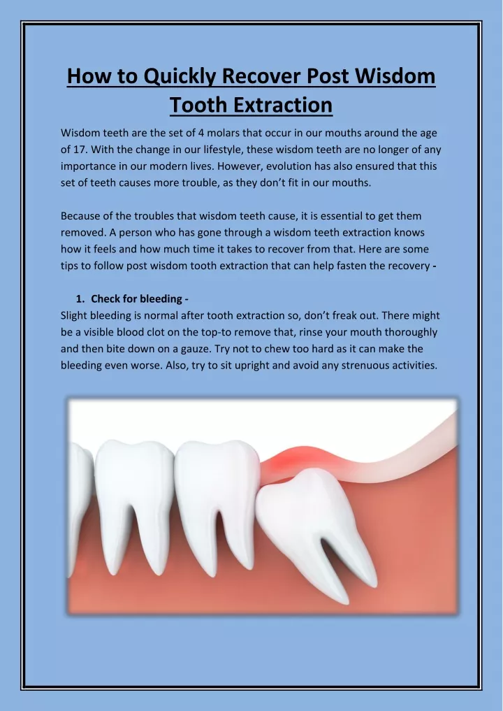 how to quickly recover post wisdom tooth