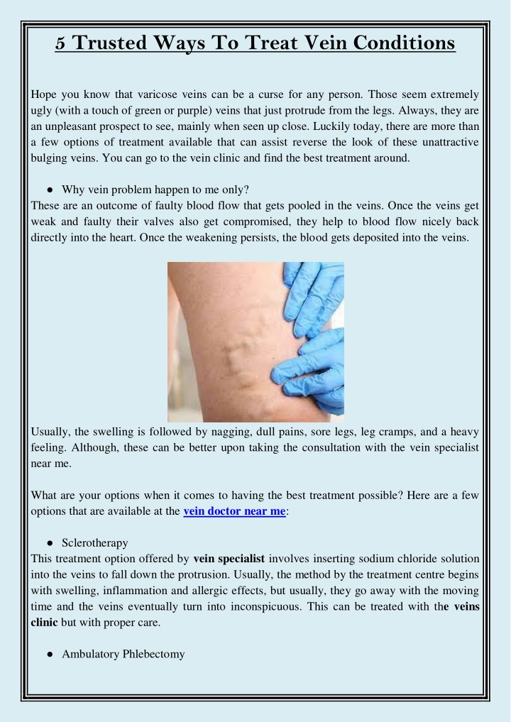5 trusted ways to treat vein conditions