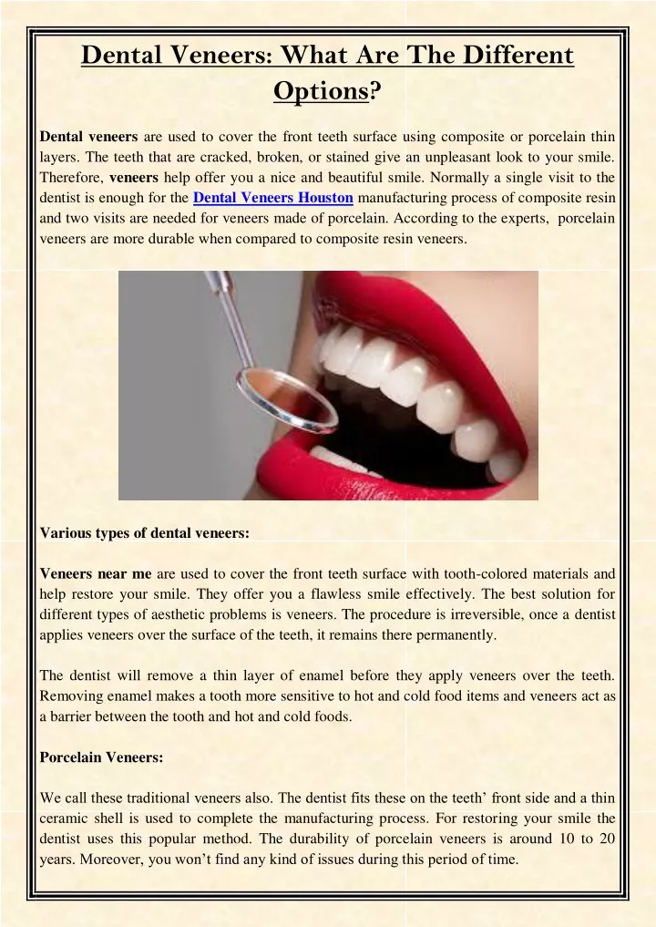 dental veneers what are the different options