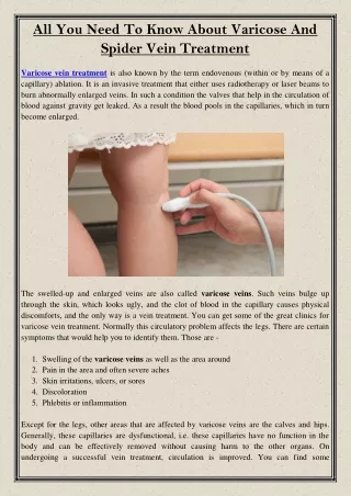all you need to know about varicose and spider