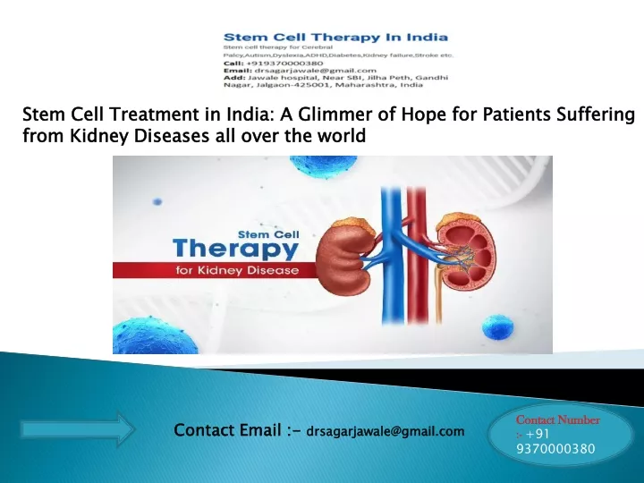 stem cell treatment in india a glimmer of hope