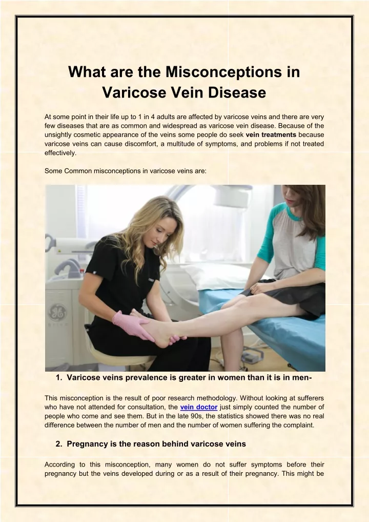 what are the misconceptions in varicose vein